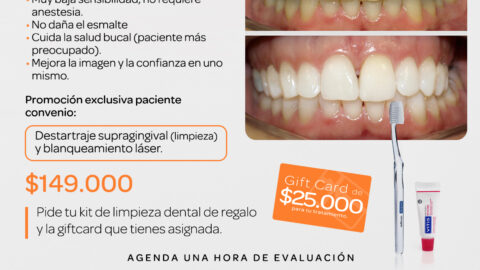 Descuento en blanqueamiento dental